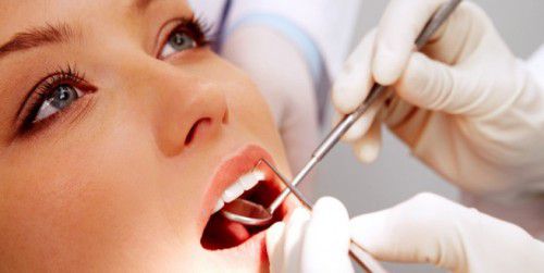 Cạo vôi răng có làm hại men răng không? 2