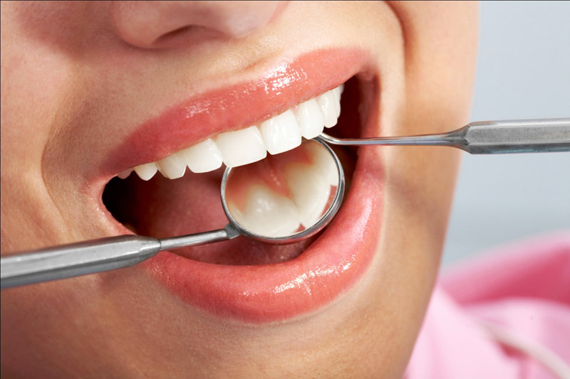 Cạo vôi răng có làm hại men răng không? 3