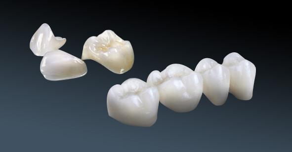 Răng sứ Cercon 1