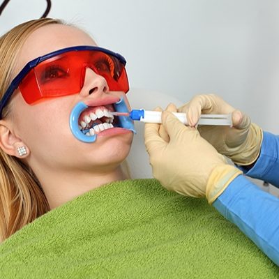 Tẩy trắng răng hiệu quả