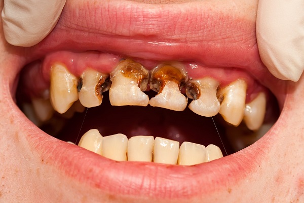 Chăm sóc sức khoẻ răng miệng của con trẻ
