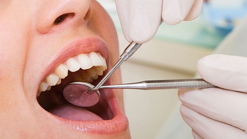 Chảy máu chân răng là dấu hiệu của bệnh gì? 1