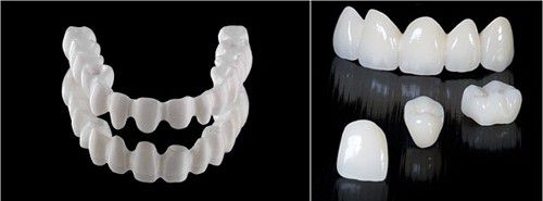 Ưu và nhược điểm của răng sứ Cercon 3