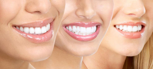 Có nên tẩy trắng răng không?