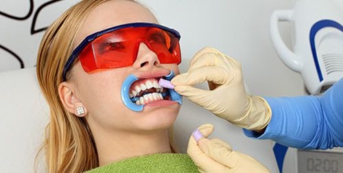 Tẩy trắng răng có đau không?
