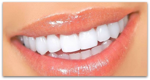 Nên tẩy trắng răng bằng phương pháp nào?
