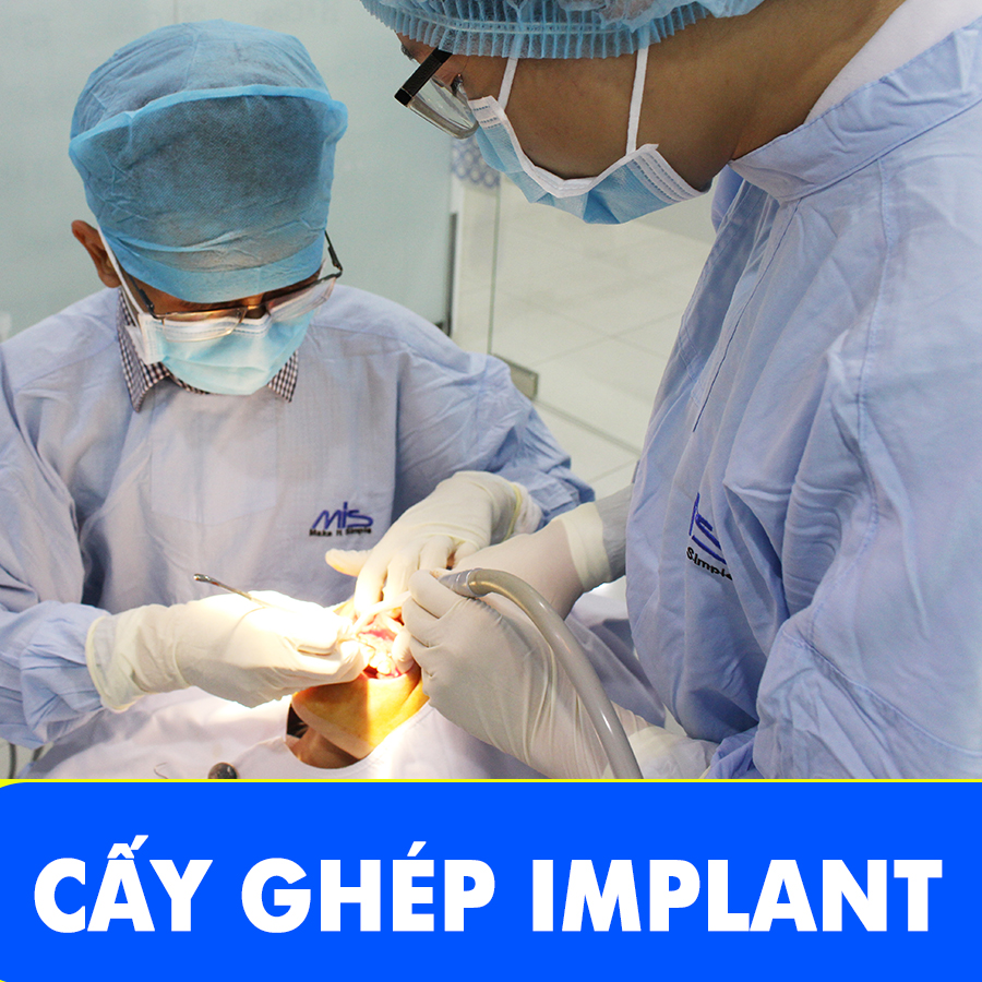 lien-ket-implant-1